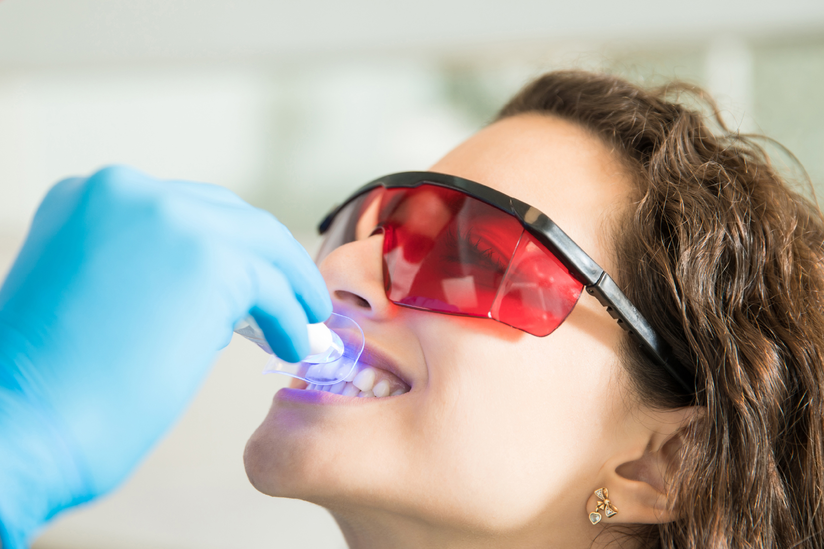 Blanqueamiento dental